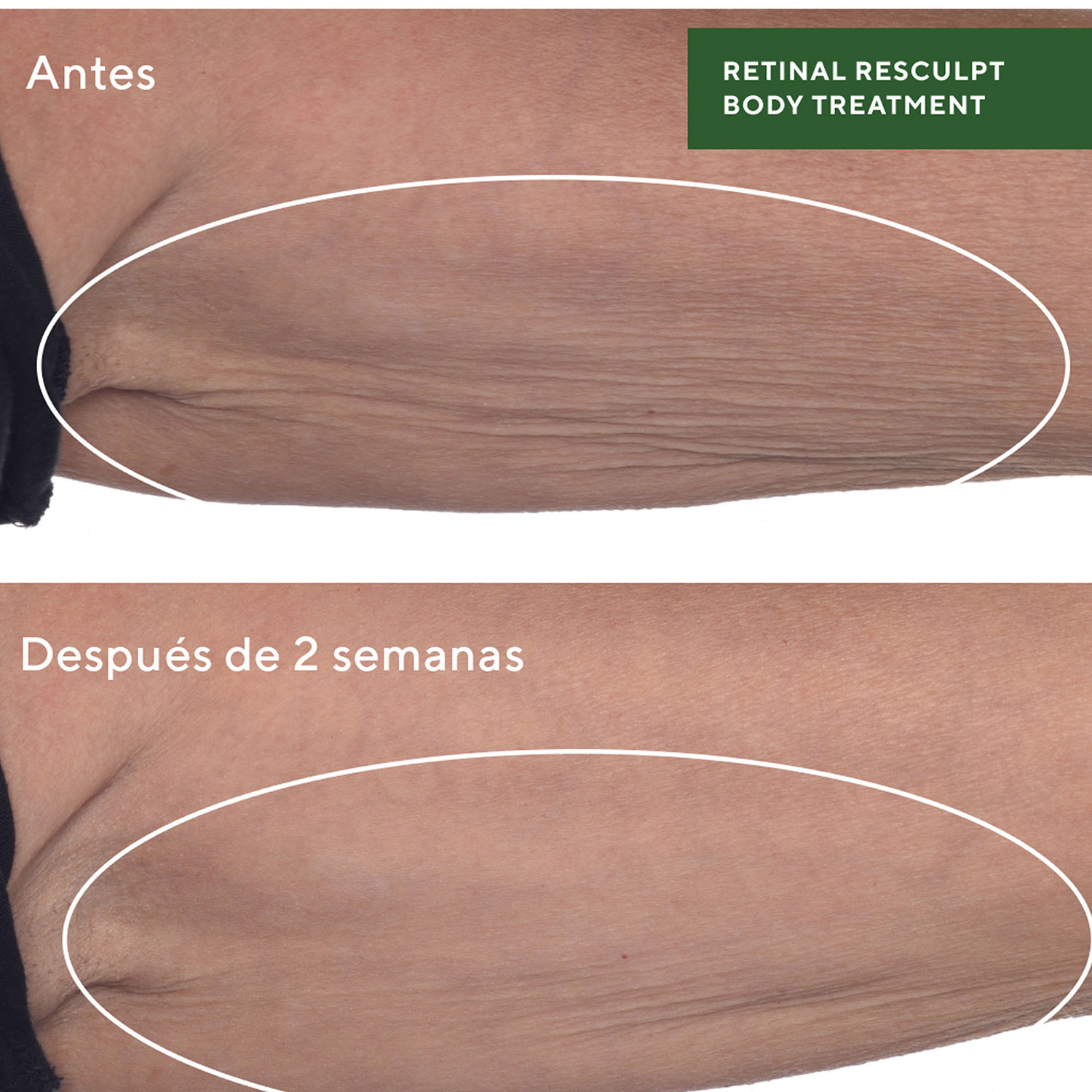 RETINAL RESCULPT BODY TREATMENT (TRATAMIENTO DE RETINAL PARA CUERPO)